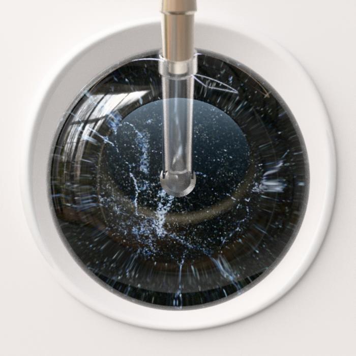 Ultrascope Stethoscope Head Black Marble / Adult Marble Stethoscope Head